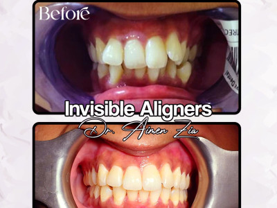 Zia Dental Care &amp; Aesthetics