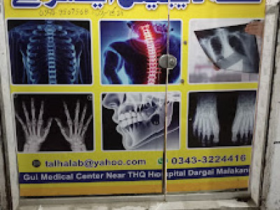 TALHA DIGITAL XRAY