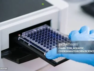 Fazal-e-haq laboratory (affordable and accurate Eliza test)