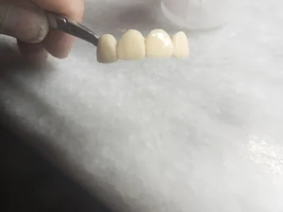 Shah Brothers Dental Lab
